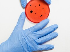 Person in blauen Handschuhen hält Petrischale